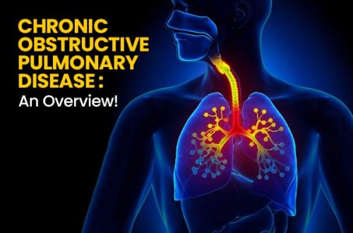 Chronic-Obstructive-Pulmonary-Disease