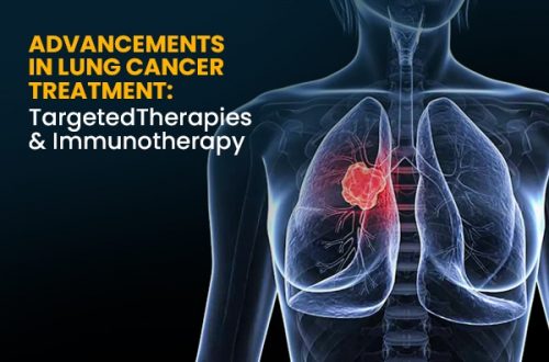 Lung Cancer Treatment Advancements